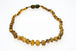 Healing Amber Necklace- 11in